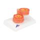 3B Scientific G50/1 COPD Bronchial Tissue Model - 3B Smart Anatomy
