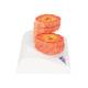 3B Scientific G50/1 COPD Bronchial Tissue Model - 3B Smart Anatomy