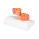 3B Scientific G50/1 COPD Bronchial Tissue Model - 3B Smart Anatomy