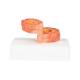 3B Scientific G50/1 COPD Bronchial Tissue Model - 3B Smart Anatomy