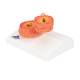 3B Scientific G50/1 COPD Bronchial Tissue Model - 3B Smart Anatomy