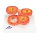 3B Scientific G50/1 COPD Bronchial Tissue Model - 3B Smart Anatomy