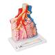 3B Scientific G60 Pulmonary Lobule with Surrounding Blood Vessels - 3B Smart Anatomy