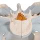 3B Scientific H21/2 Male Pelvis with Ligaments Model (2 Parts) - 3B Smart Anatomy
