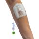 IV Glove IVGA0005 Easystick on the Forearm, Closed Dome (IV Catheter, Extension Tubing, and other Accessories not included)