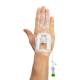 IV Glove IVGA0005 Easystick on the back of the Right Hand, Opened Dome (IV Catheter, Extension Tubing, and other Accessories not included)