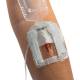 IV Glove IVGA0005 Easystick on the Forearm, Closed Dome - Close-up View (IV Catheter, Extension Tubing, and other Accessories not included)