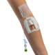 IV Glove IVGA0005 Easystick on the Forearm, Opened Dome (IV Catheter, Extension Tubing, and other Accessories not included)