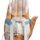 IV Glove IVGA0008 Duo - Adult and Pediatric on the back of the Hand, Opened Dome - Close-up View (IV Catheter and Extension Tubing not included)