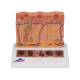 3B Scientific J15 Skin Cancer Model - Enlarged 8 Times, 3B Smart Anatomy