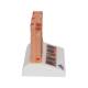 3B Scientific J15 Skin Cancer Model - Enlarged 8 Times, 3B Smart Anatomy