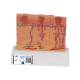 3B Scientific J15 Skin Cancer Model - Enlarged 8 Times, 3B Smart Anatomy