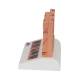3B Scientific J15 Skin Cancer Model - Enlarged 8 Times, 3B Smart Anatomy