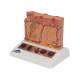 3B Scientific J15 Skin Cancer Model - Enlarged 8 Times, 3B Smart Anatomy
