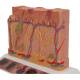 3B Scientific J15 Skin Cancer Model - Enlarged 8 Times, 3B Smart Anatomy