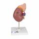 Kidney with Adrenal Gland (2 Parts) - 3B Smart Anatomy