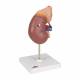 3B Smart Anatomy Kidney with Adrenal Gland (2 Parts) Model K12