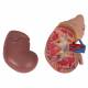 3B Smart Anatomy Kidney with Adrenal Gland (2 Parts) Model K12