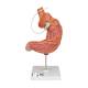 3B Scientific K15/1 Gastric Band Model
