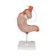 3B Scientific K15/1 Gastric Band Model