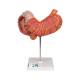 3B Scientific K16 Stomach Model 3-Part - 3B Smart Anatomy