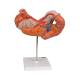 3B Scientific K16 Stomach Model 3-Part - 3B Smart Anatomy