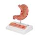 3B Scientific K17 Stomach Model with Ulcers - 3B Smart Anatomy