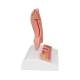 3B Scientific K17 Stomach Model with Ulcers - 3B Smart Anatomy