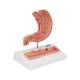 3B Scientific K17 Stomach Model with Ulcers - 3B Smart Anatomy