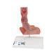 3B Scientific K18 Diseases of the Esophagus Model - 3B Smart Anatomy