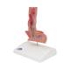 3B Scientific K18 Diseases of the Esophagus Model - 3B Smart Anatomy