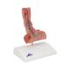 3B Scientific K18 Diseases of the Esophagus Model - 3B Smart Anatomy