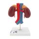 3B Scientific K22-1 Kidneys with Vessels Model 2-Part - 3B Smart Anatomy