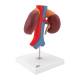 3B Scientific K22-1 Kidneys with Vessels Model 2-Part - 3B Smart Anatomy