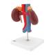 Kidneys with Vessels Model 2-Part - 3B Smart Anatomy