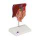 3B Scientific K26 Gallstone Model