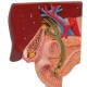 3B Scientific K26 Gallstone Model