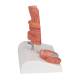 3B Scientific K27 Hemorrhoid Model - 3B Smart Anatomy