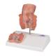 3B Scientific K27 Hemorrhoid Model - 3B Smart Anatomy