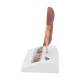 3B Scientific K29 Kidney Stone Model - 3B Smart Anatomy