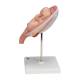 3B Scientific L10/7 Fifth Month Twin Fetus Model - Normal Position