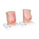 3B Scientific L56 Model of the Female Breast with Healthy and Unhealthy Tissue