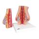 3B Scientific L56 Model of the Female Breast with Healthy and Unhealthy Tissue