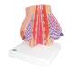 3B Scientific L56 Model of the Female Breast with Healthy and Unhealthy Tissue