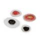 Life/form Moulage Wound - Moles/Skin Cancer Simulator - Set of 4