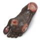 Life/form Elderly Pressure Ulcer Foot - Dark