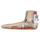3B Scientific M31 Flat Foot (Pes Planus) Model - Light Skin Tone