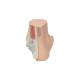 3B Scientific M31 Flat Foot (Pes Planus) Model - Light Skin Tone