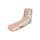 3B Scientific M31 Flat Foot (Pes Planus) Model - Light Skin Tone