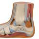 3B Scientific M31 Flat Foot (Pes Planus) Model - Light Skin Tone